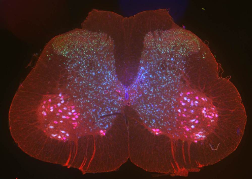 sc-ihc-from-alavarez-lab-wsu