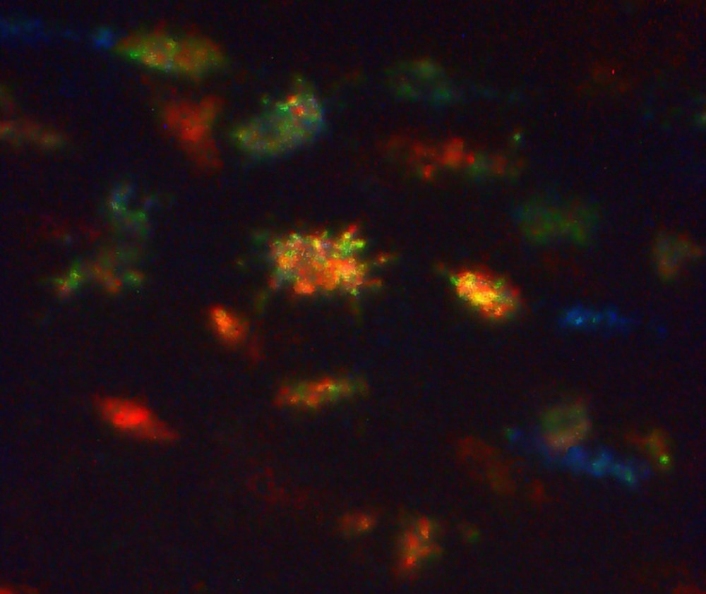 Lucy_Osteocytes_1024x1024