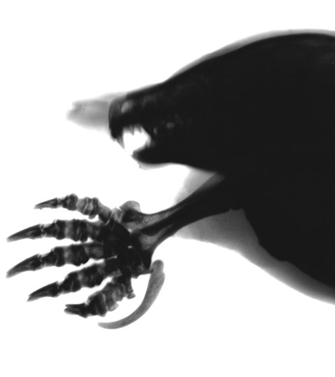 Peter Deane BBC mole x ray