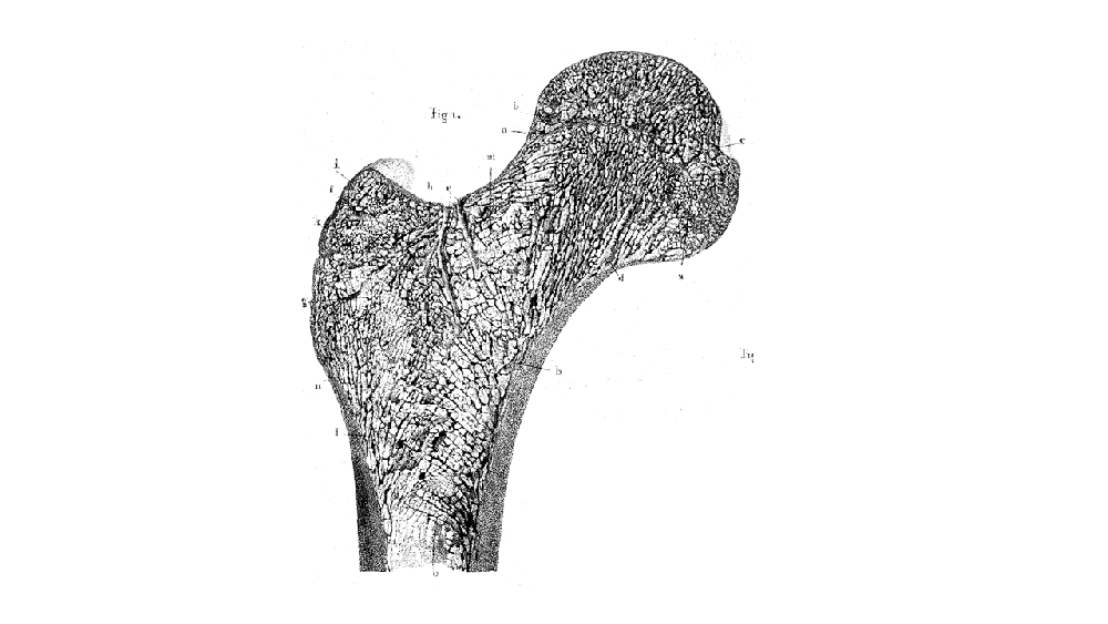 figure 3 proximal femur