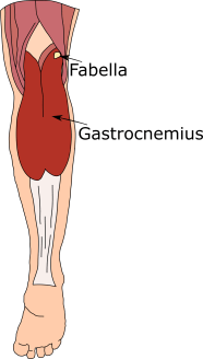 In Focus The Fabella The Forgotten Knee Bone Anatomy To You In Focus The Fabella The Forgotten Knee Bone Anatomy To You